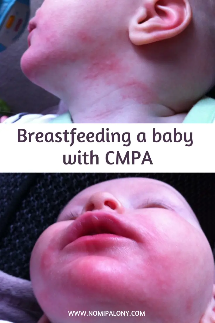 My top tips CMPA and breastfeeding - including my experience, my baby's symptoms; and snack/recipe suggestions.
