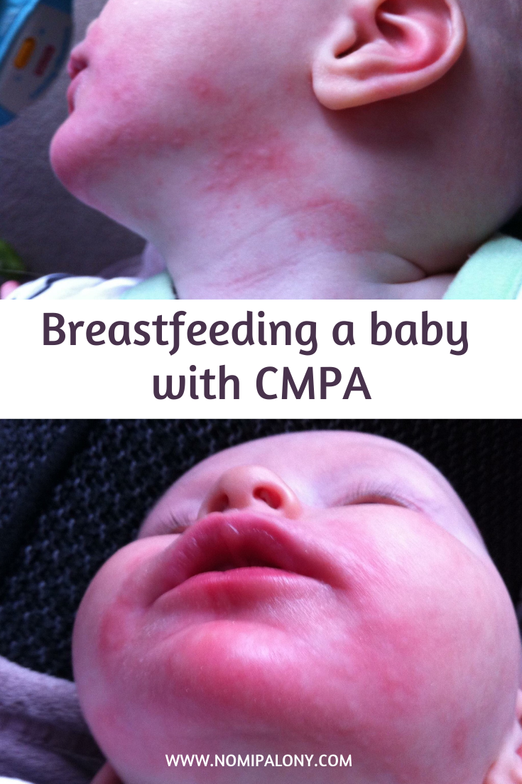 My top tips CMPA and breastfeeding - including my experience, my baby's symptoms; and snack/recipe suggestions.