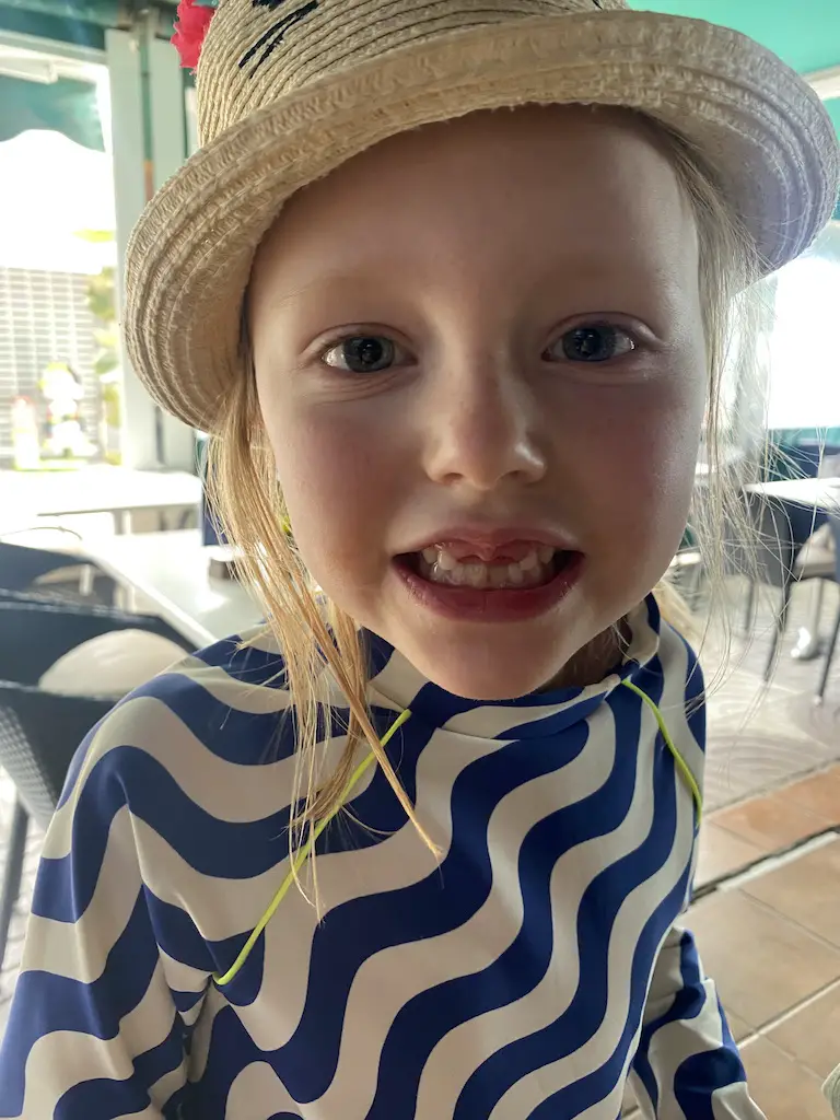 Blonde little girl shows off gap where front teeth should be